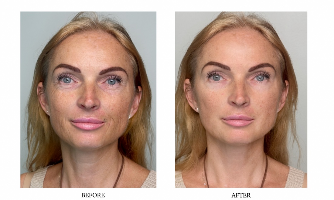 Customer before and after result 2