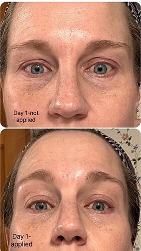Lindsy customer result after