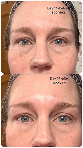 Lindsy customer result before