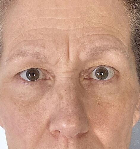 Leslie customer result after