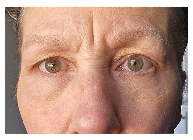 Leslie customer result before