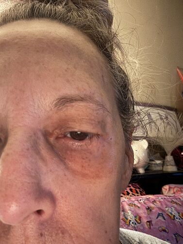 Karla customer result after