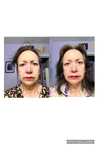 Natalie customer result