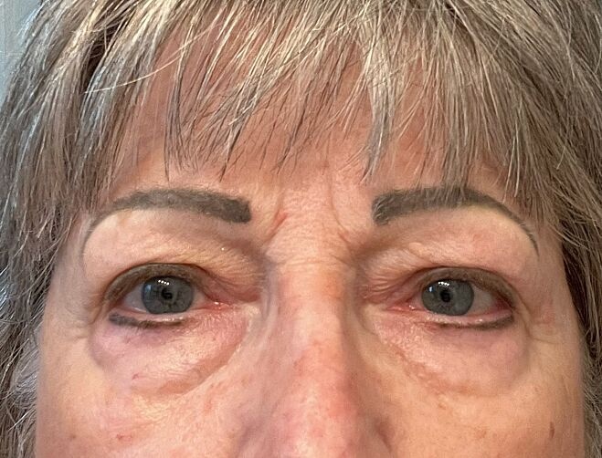 Bella customer result before