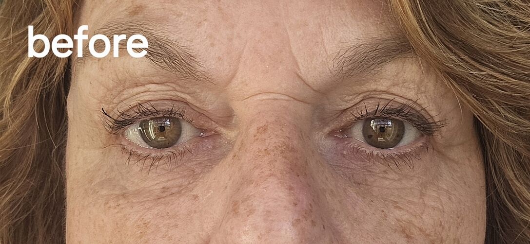 Michele customer result after