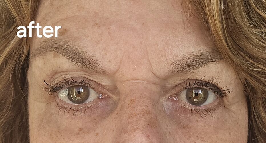 Michele customer result before