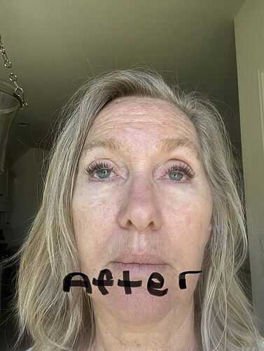 Cindy customer result after